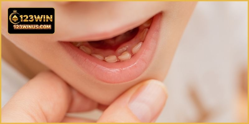 Mơ Thấy Rụng Răng Là Điềm Gì? Giải Mã Con Số 123WIN Sổ mơ 123WIN giải mã giấc mơ rụng răng trong gương